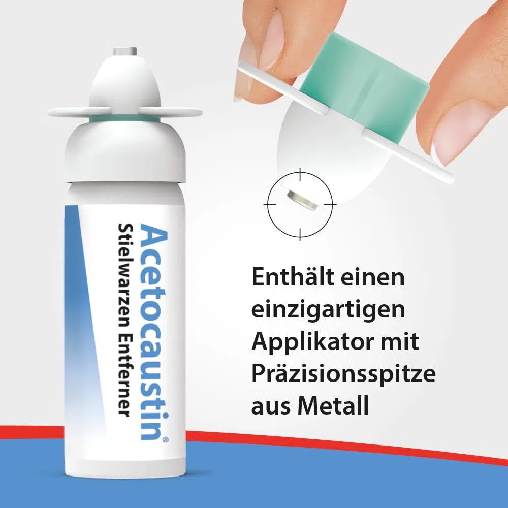 Acetocaustin Stielwarzen Entferner | Entfernt Stielwarzen | Entfernung durch Vereisung der Stielwarze | 12 Anwendungen | 50ml