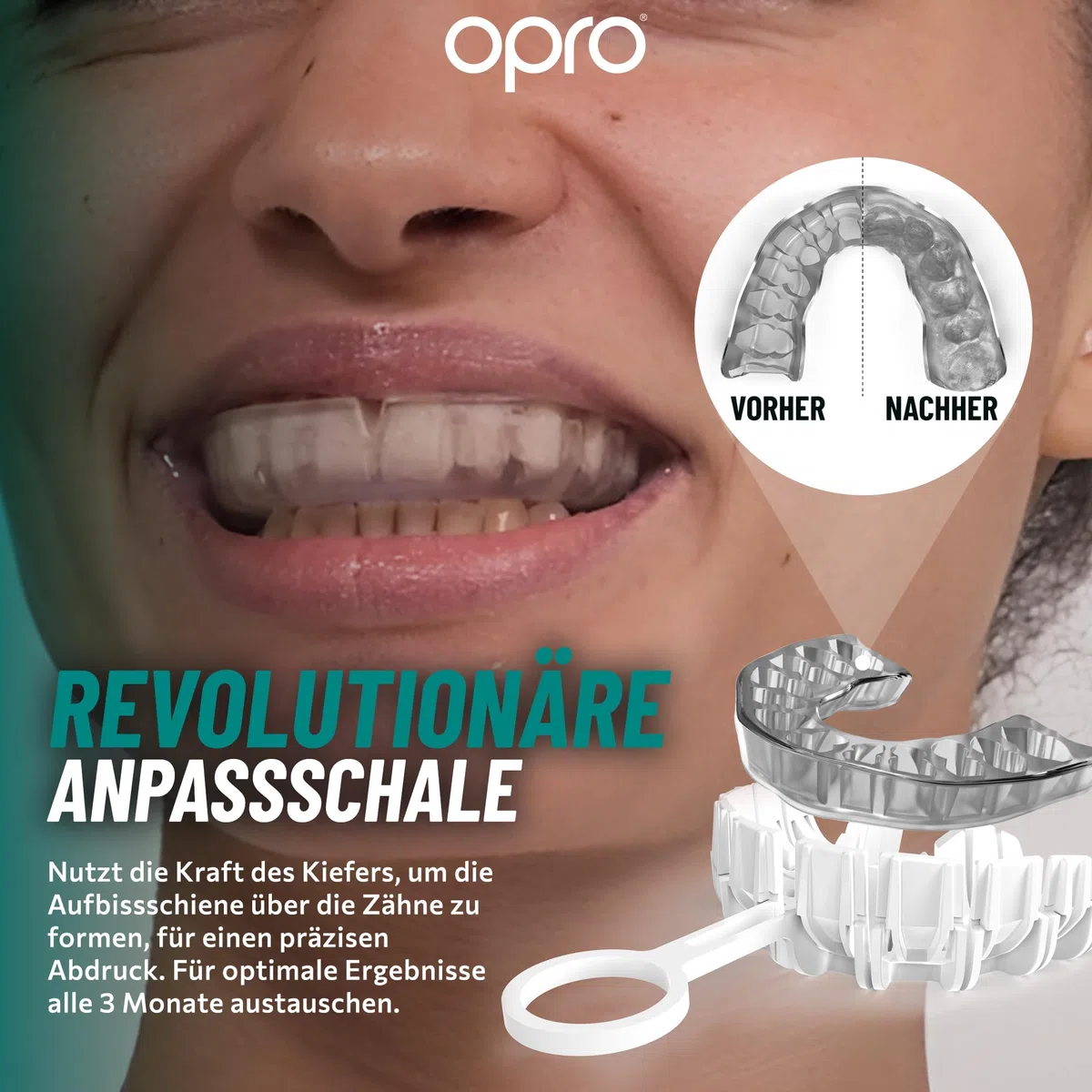 OPRO Aufbissschiene gegen Zähneknirschen – Individuell anpassbarer Bruxismus Mundschutz bei Knirschen – Komfortabel, flexibel & BPA-frei – Klinisch geprüft mit Aufbewahrungsbox – Hergestellt im UK