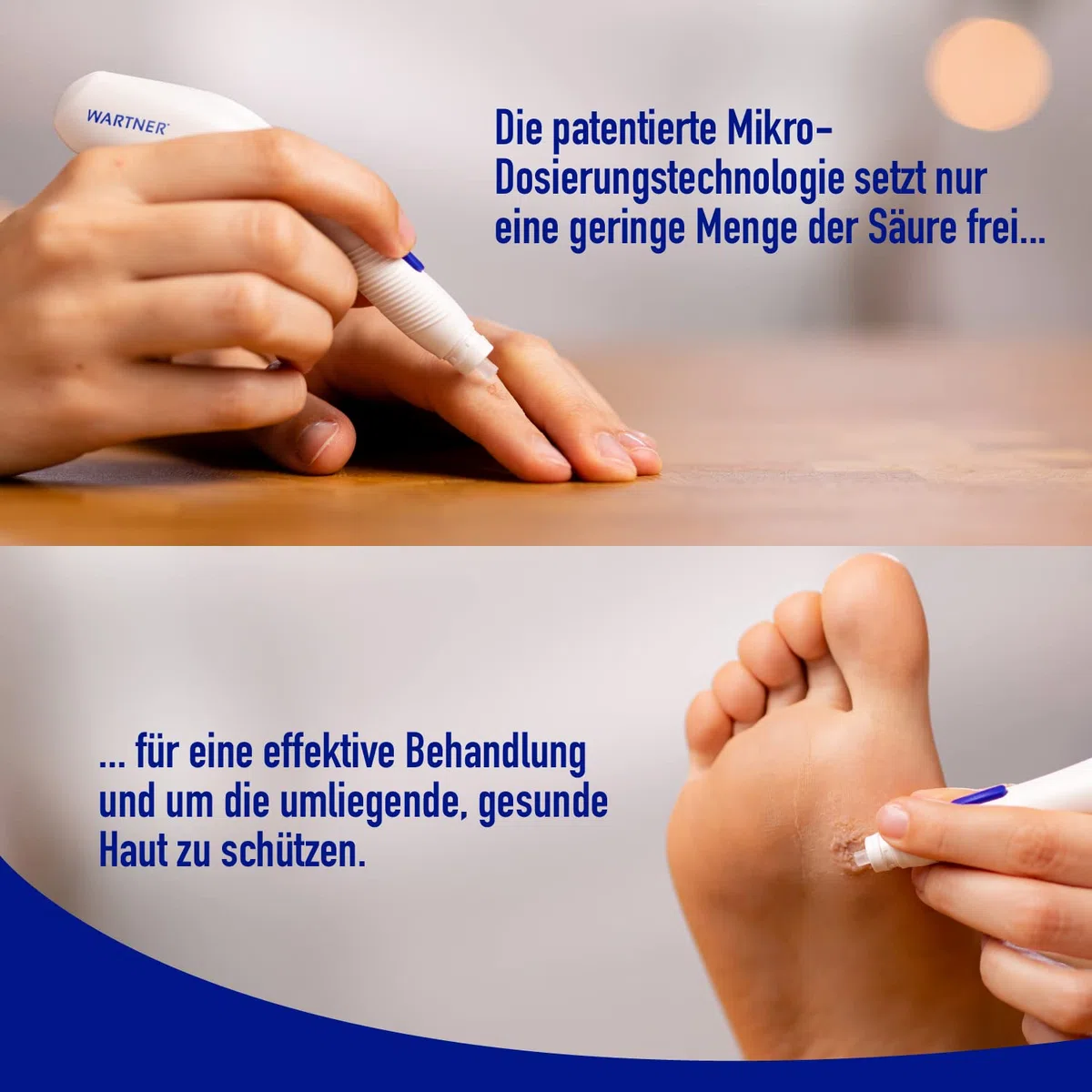 WARTNER Stift gegen Warzen - Warzenstift zur schnellen und effektiven Anwendung - Warzenbehandlung mit Trichloressigsäure - 1er Pack