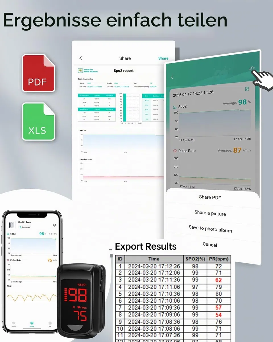 Pulsioximetro Bluetooth Con APP Gratis, Monitor von Oxigeno dedo Adultos para Ritmo Cardiaco Saturacion von Oxigeno in Blut, inklusive Tasche und Lanyard()