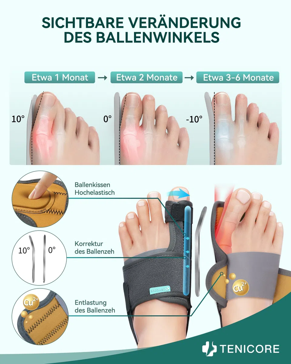 Verbessert Hallux Valgus Korrektur Mit 2 Winkeleisen Verdickt Silikonpad Zehenspreizer Zehenschutz 1 Paar Hallux Valgus Schiene Socken Bandage Damen und Herren